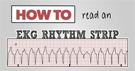 how to read an ekg strip.